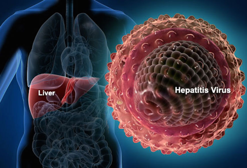 What Is Hepatitis C?