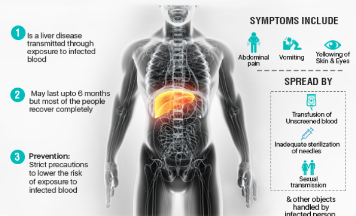 Hepatitis C Symptoms And Causes