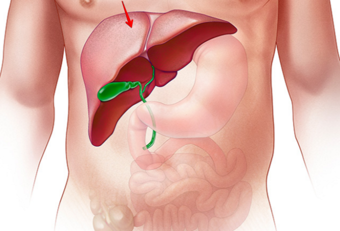 Hepatitis Overview