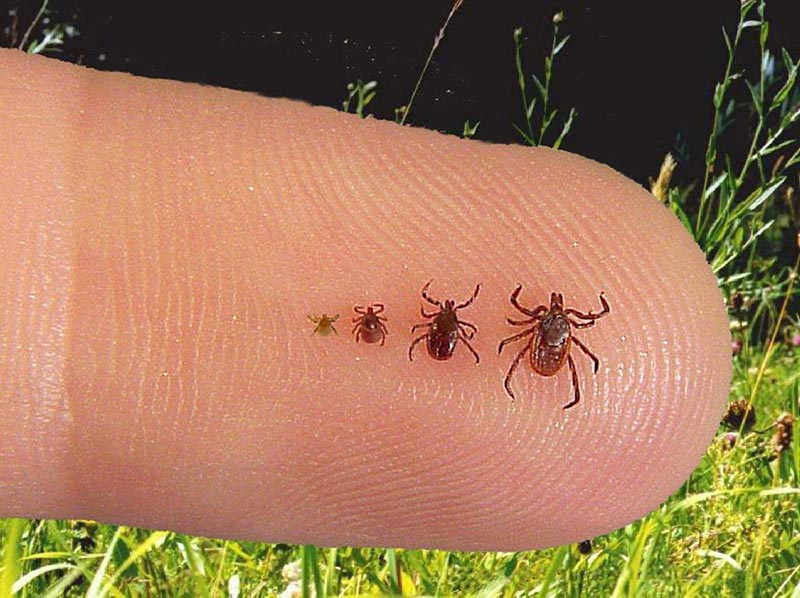 What Is Babesiosis?(Babesia)