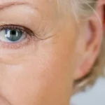 Age-Related Macular Degeneration (AMD) - Symptoms, Causes, Stages, Diagnosis, and Treatment - Health Care Tips Hub