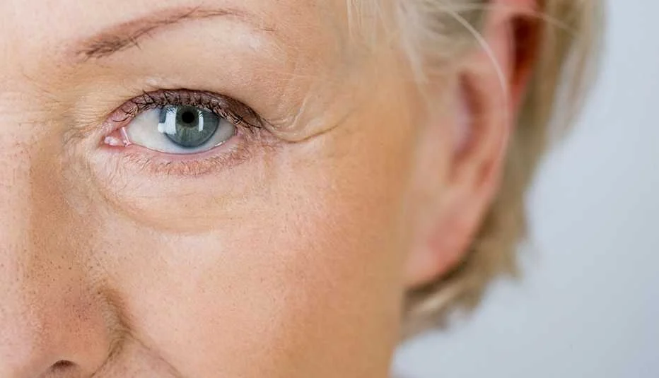 Age-Related Macular Degeneration (AMD) - Symptoms, Causes, Stages, Diagnosis, and Treatment - Health Care Tips Hub