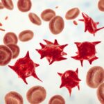 What Is Acanthocytosis?