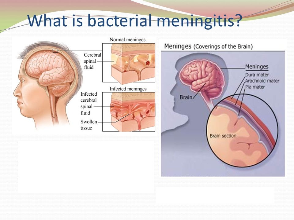 Bacterial meningitis: Symptoms, causes, and treatment