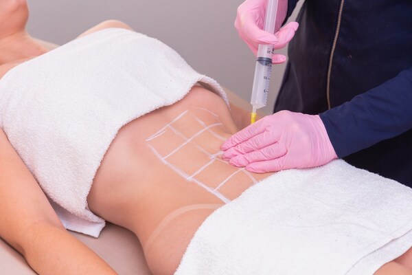 1. Acquired Lipodystrophy: Causes, Symptoms, Diagnosis & Latest Treatment Options