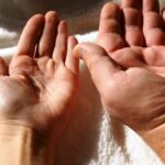 Acromegaly: Causes, Symptoms, Diagnosis & Treatment Options