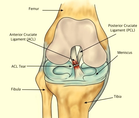 Anterior Cruciate Ligament (ACL)