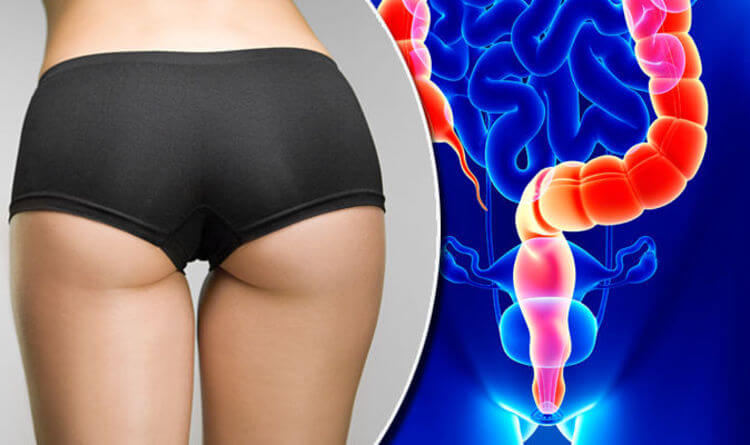 About Anal Cancer: Symptoms, causes, and treatments