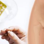 Hormone Replacement Therapy