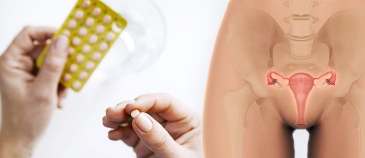 Hormone Replacement Therapy