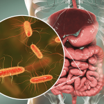e.coli infection