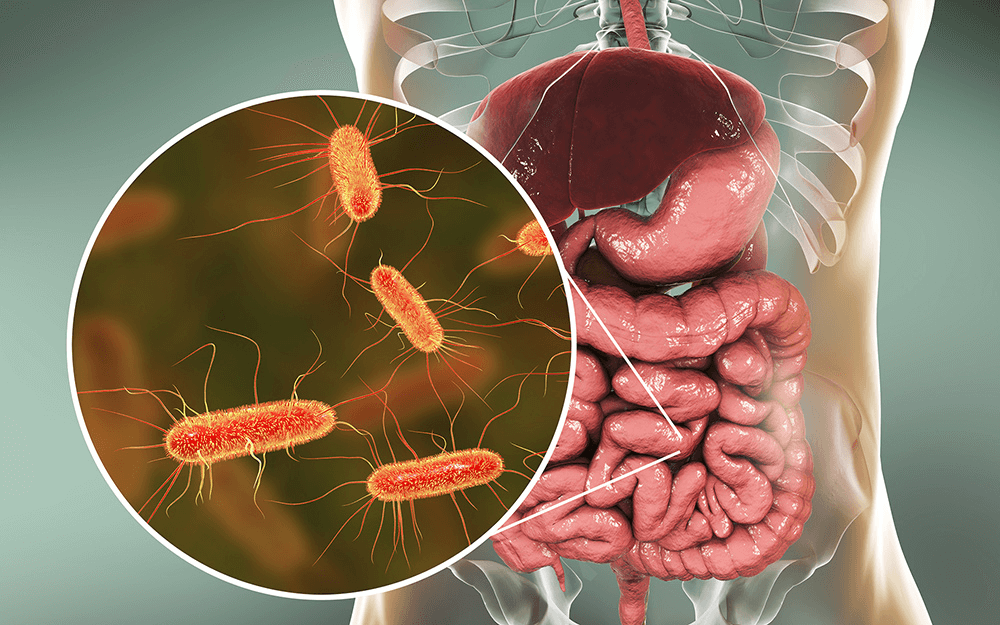 e.coli infection