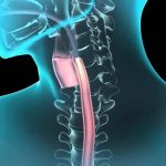 What Is Endoscopy and Types of Endoscopy