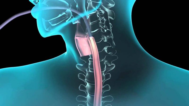 What Is Endoscopy and Types of Endoscopy